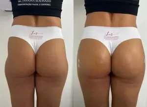 Resultado bumbum (1)