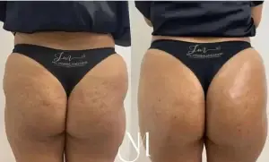 Resultado bumbum (3)